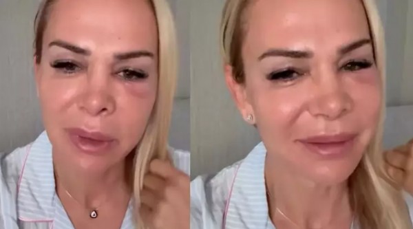 Nagihan Karadere’nin paylaşımı korkuttu